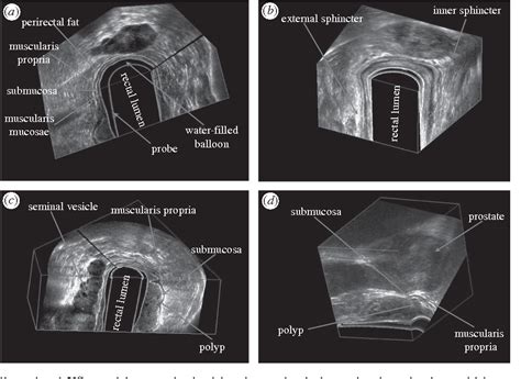 Figure 5 From Three Dimensional Ultrasound Scanning Semantic Scholar