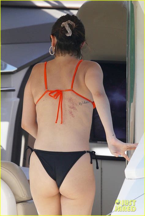 Selena Gomez Seemingly Responds To Bikini Photos Showing Her Surgery Scars Photo