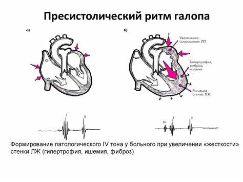 Хроническая недостаточность кровообращения диета Недостаточность кровообращения. Классификация недостаточности Недостаточность кровообращения. Классификация недостаточности Хроническая недостаточность кровообращения диета
