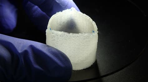 Artificial Heart Valves That Evolve Into A Patients Own Tissue