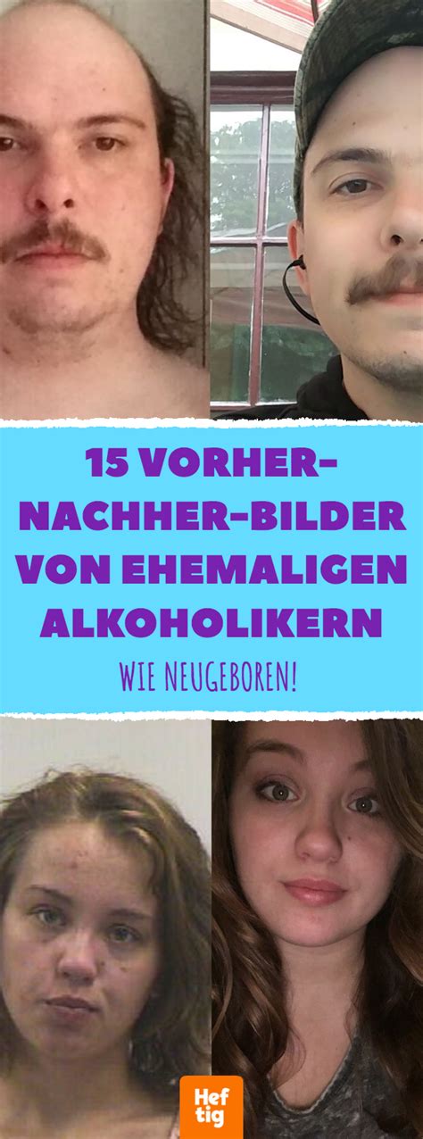 Vorher Nachher Bilder Von Ehemaligen Alkoholikern