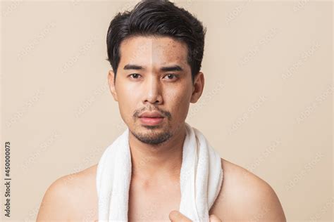 Comparison Face Of Asian Man Before And After Facial Skin Care