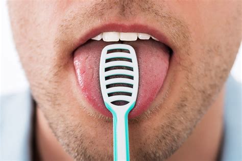 what causes bad breath halitosis