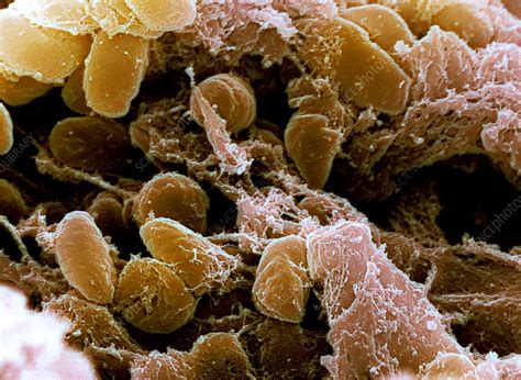 After concurrent bubonic plague and smallpox outbreaks, i'm left with a baby king and no heir. Plague bacteria, Yersinia pestis, SEM - Stock Image - B220 ...