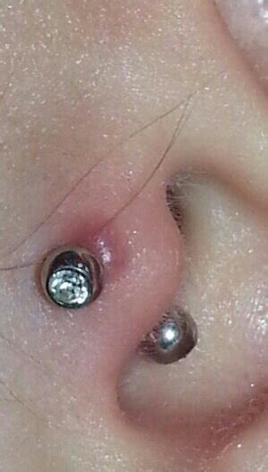 My Tragus Is Infected Beautylish