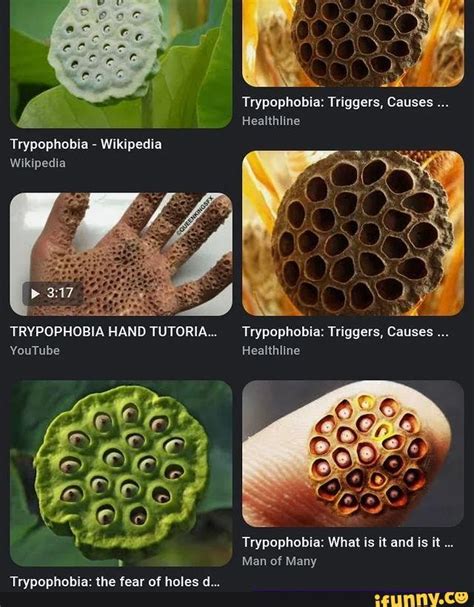 Ye Trypophobia Triggers Causes Healthline Trypophobia Wikipedia Wikipedia Trypophobia Hand