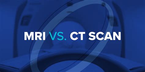 Everything You Need To Know About Ct Vs Mri Scans Mri