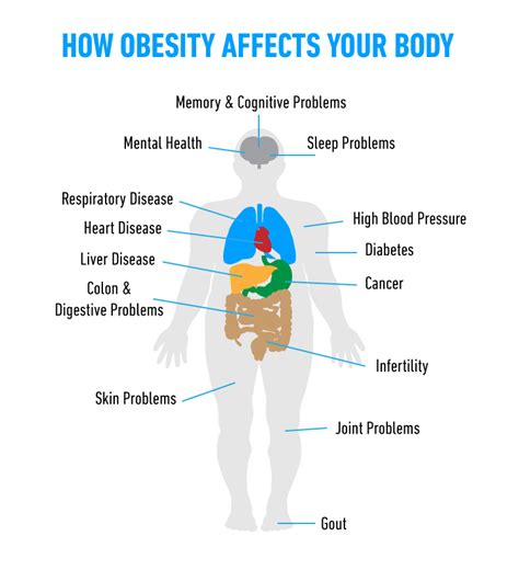 How Obesity Affects Your Body Angeles Health Mexico