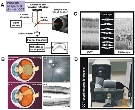Principle Of Optical Coherence Tomography OCT And Its Application In