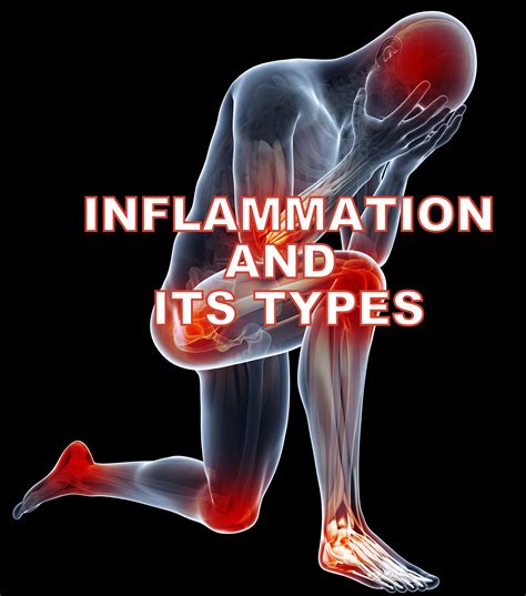 Inflammation- Definition, Causes and Types of Inflammation | Simplynotes