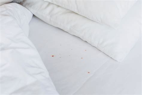 Think You Have Bed Bugs Heres How To Deal With Pesky Bed Bug Stains