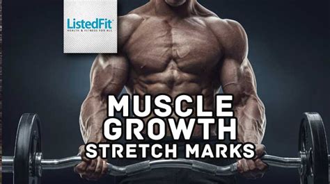 Stretch Marks From Muscle Growth All You Need To Know