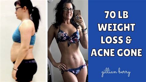 Raw Vegan Before And After Transformation 70lb Weight Loss Acne