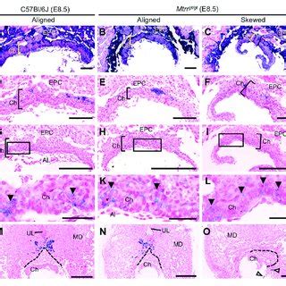 Spectrum Of Phenotypes Observed In Mtrr Gt Gt Mouse Conceptuses At