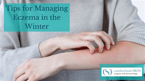 Ward Off Eczema Flare Ups This Winter With Our Top Tips