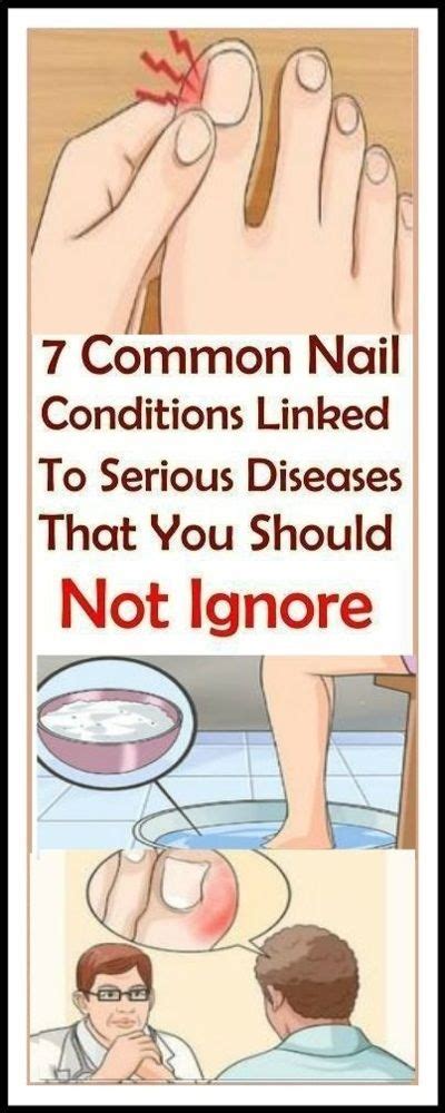 7 common nail conditions linked to serious diseases that you shouldn t ignore nail conditions