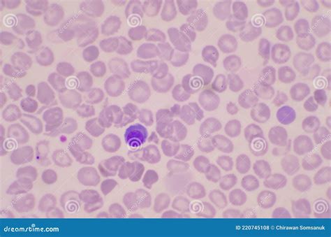Nucleated Red Blood Cells Nrc In Blood Smear Stock Photo Image Of