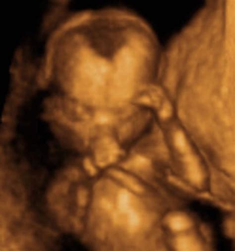 16th Week Ultrasounds Pregnancy Ultrasound 3d And 3d Ultrasound