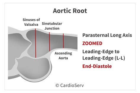 Back To The Basics Aortic Valve Anatomy Cardioserv