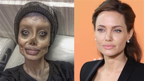 Esta Mulher Fez 50 Plásticas Para Se Parecer Com A Angelina Jolie