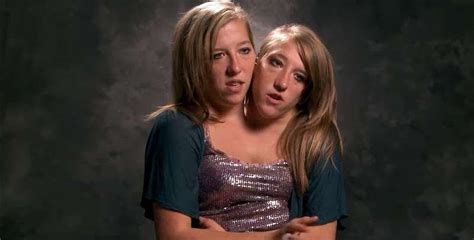 Where Are Conjoined Twins Abby And Brittany Hensel Today Vision Viral