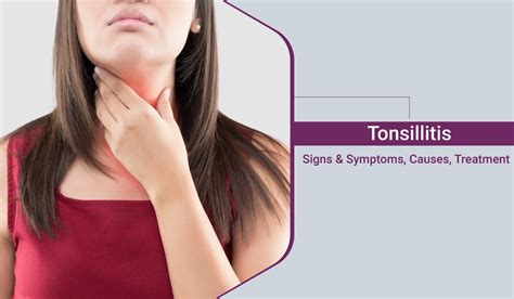 Tonsillitis Signs And Symptoms Causes Treatment