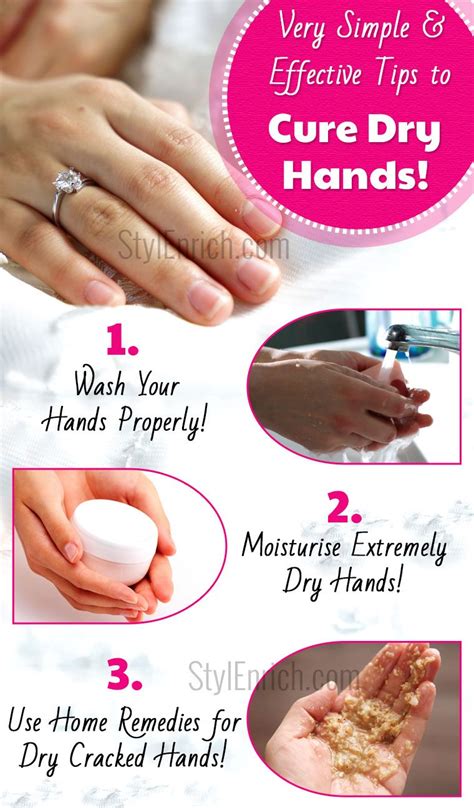 Home Remedies For Dry Cracked Hands Hands Care Tips