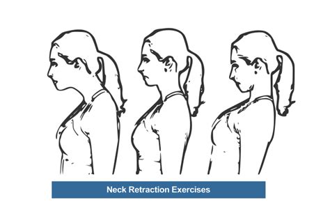 Neck strengthening exercises (easy to hard) good for whiplash, arthritis, etc. Neck Exercises to Reduce Pain | Reinhardt Chiropractic