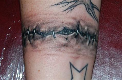 Stitches Tattoo Flickr Photo Sharing