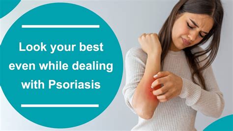 Dressing Tips For Psoriasis Patients Look Best While Dealing With