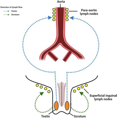 Lymphatic Drainage Of The Testes And Scrotum Lymphatics From The Testes