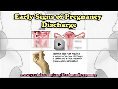 White discharge during pregnancy is normal if it looks clear, is thin and milky, and has a mild smell. Early Signs of Pregnancy Discharge - YouTube