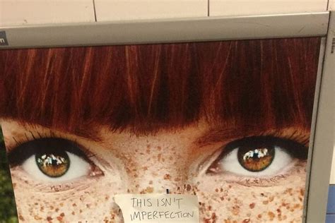 S Redhead Freckles Advert Controversy Glamour Uk