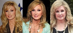 Morgan Fairchild Plastic Surgery Before and After Pictures 2024