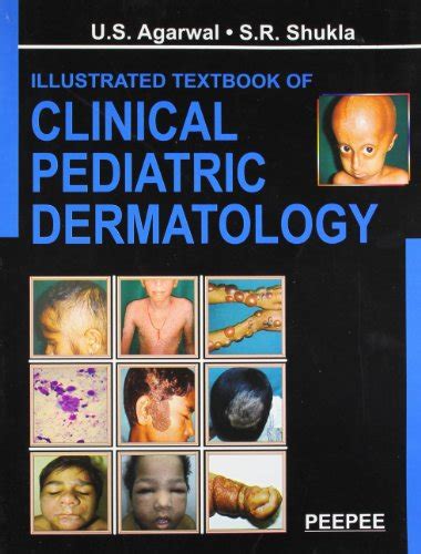 illustrated textbook of clinical pediatric dermatology by u s agarwal goodreads