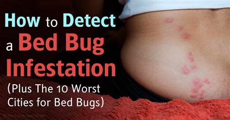 Bed Bug Infestations Soaring In The Us