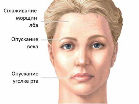 Диета лицевого неврита Неврит лицевого нерва: причины, лечение, симптомы Неврит лицевого нерва: причины, лечение, симптомы Диета лицевого неврита