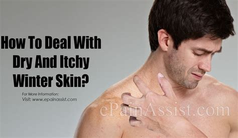 How To Deal With Dry And Itchy Winter Skin