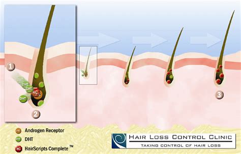 Aa Complete Information Restorative Therapeutic Hair Loss Control
