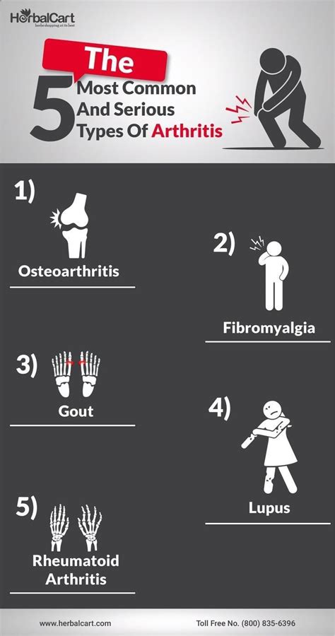 Most Common Types Of Arthritis