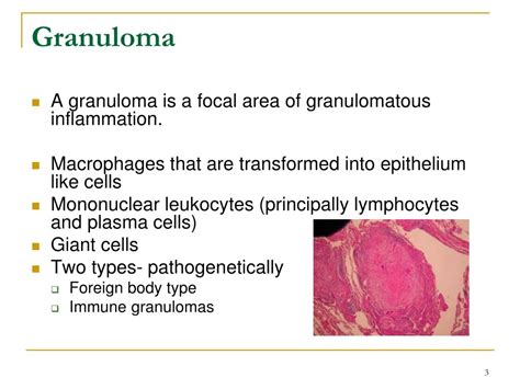 Ppt What Is Granuloma Powerpoint Presentation Free Download Id