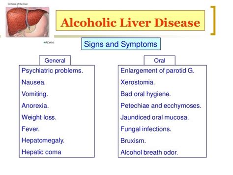 Signs And Symptoms Of Alcoholic Liver Disease
