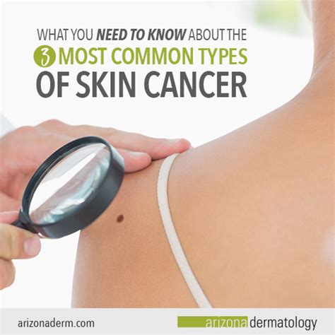 The Most Common Types Of Skin Cancer