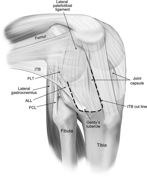 The Role Of The Peripheral Passive Rotation Stabilizers Of The Knee