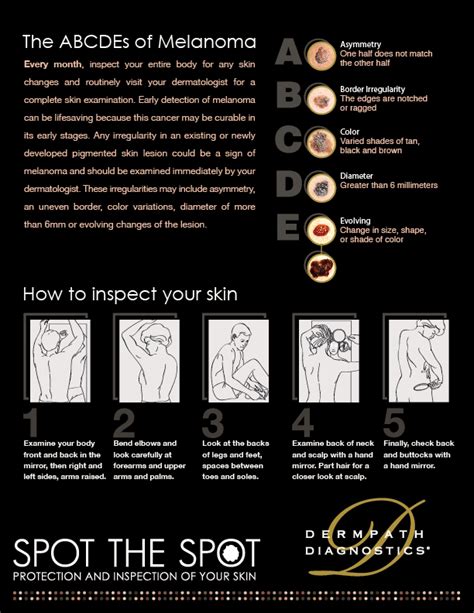 Abcdes Of Melanoma Dermpath Diagnostics