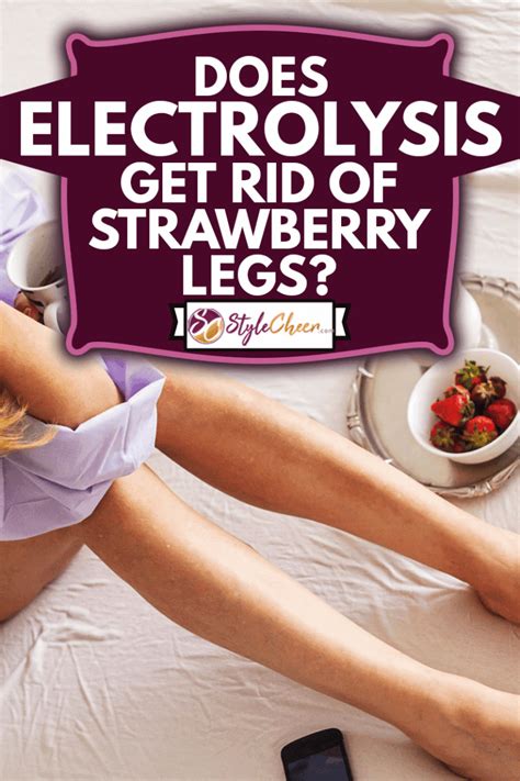 Does Electrolysis Get Rid Of Strawberry Legs