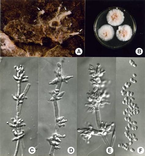 Paecilomyces Fumosoroseus Alchetron The Free Social Encyclopedia