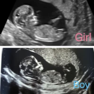 Ab wann sieht man geschlecht des kindes. Schwangerschaft Geschlecht Des Kindes - Captions Update Trendy