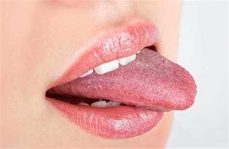 Preventive Dentistry Belle Fourche Dental 5 Secrets Your Tongue