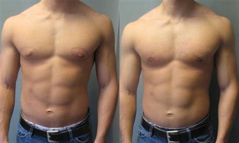 What Exercises Get Rid Of Belly Fat For Men Reduced Testosterone Side